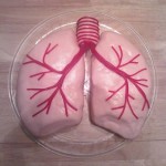 a97465_g211_8-lung